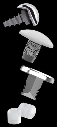 An isolated graphic displaying various conventional competitor cartilage repair devices, including metal screw stems and plastic plugs.