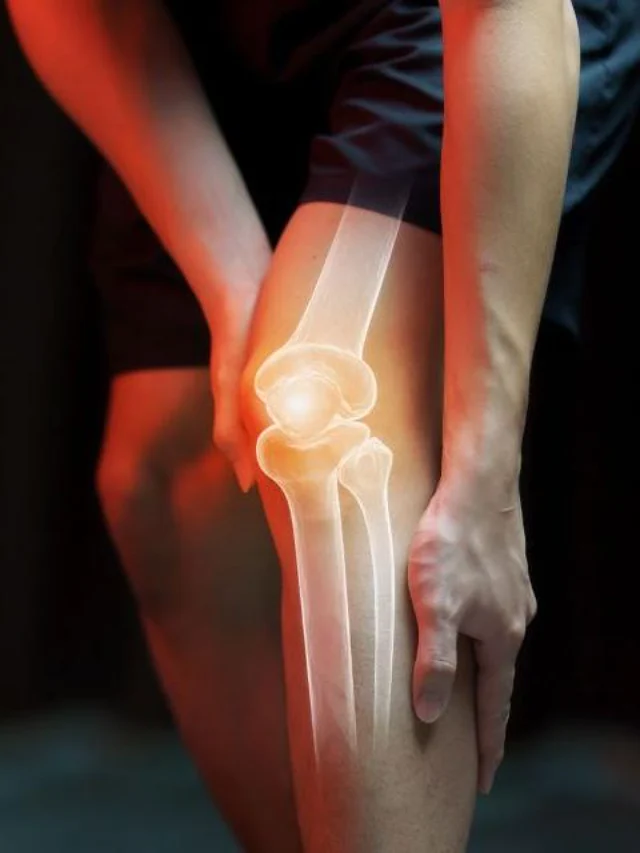 Stiff, Achy Knees? Lab-Made Cartilage Gel Outperforms the Real Thingthumbnail