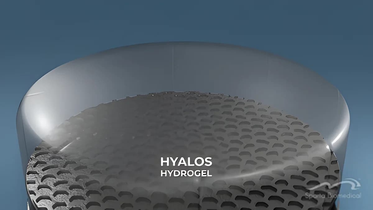Close-up 3D render of the Hyalos Hydrogel implant by Sparta Biomedical, showing a smooth, clear synthetic cartilage layer bonded to a porous, dark honeycomb textured base.