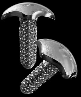 Two Sparta Biomedical Karthyx cartilage implants featuring smooth, reflective dome caps bonded to textured, porous metallic lattice anchoring stems.